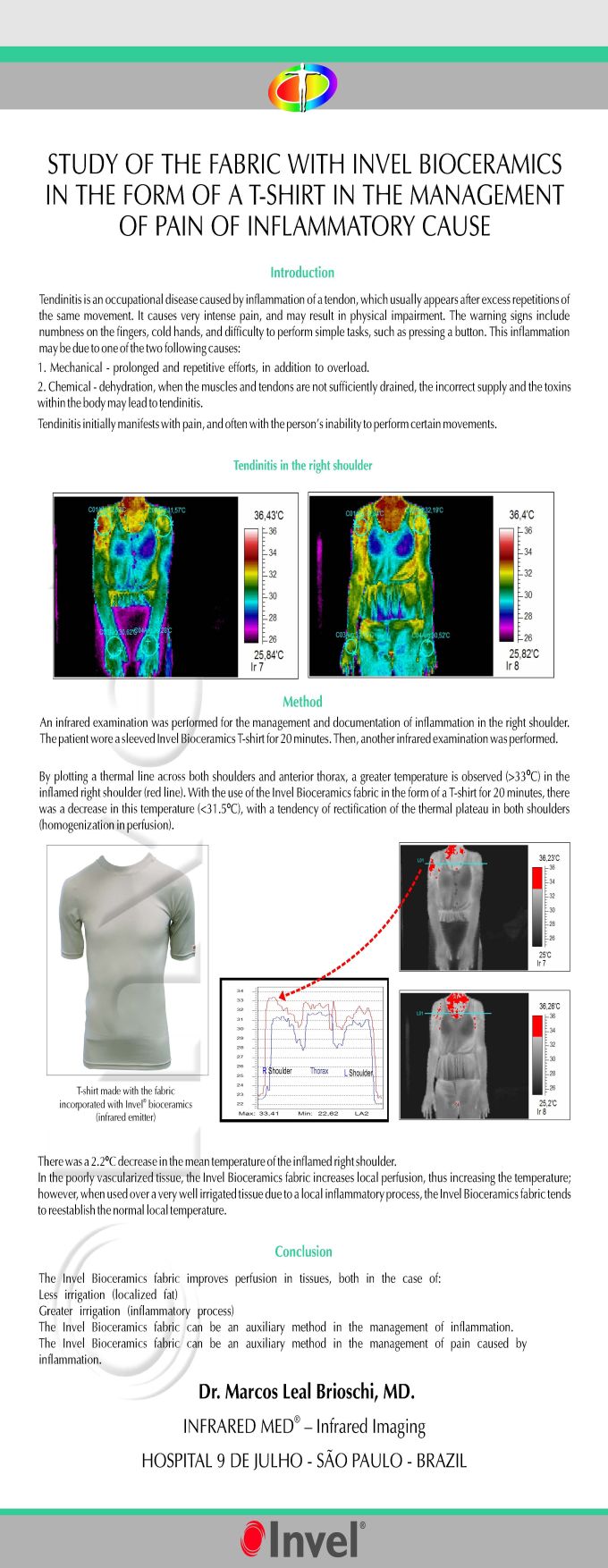 Actiive Shirt in inflammatory pain — infrared thermography