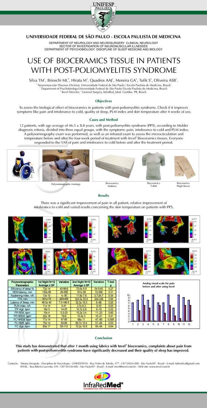 Bioceramic garments and mattress in post-poliomyelitis syndrome